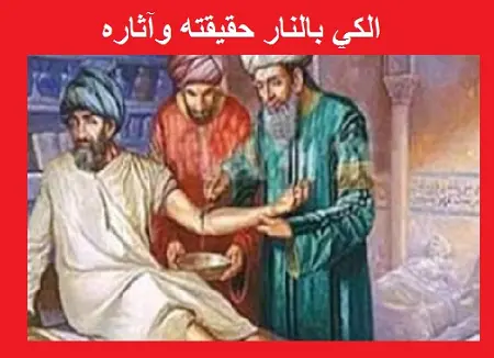 الكي بالنار حقيقته وآثاره