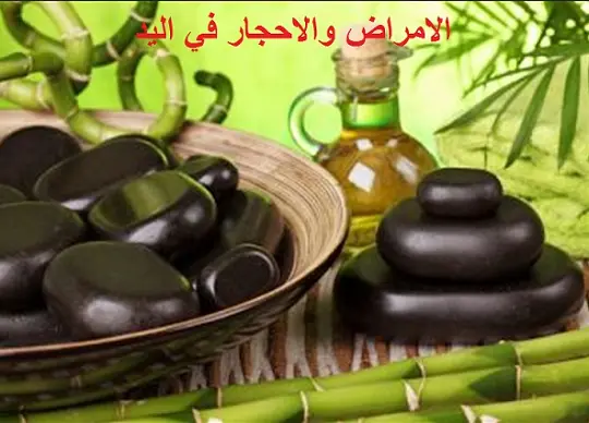 الامراض والاحجار في اليد