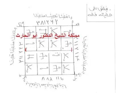 وفق للقبول و عقد السن على صفيحة فضة